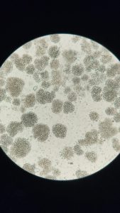 Identificación de _Microcystis spp_ . por caracterizacion de Morfoespecies